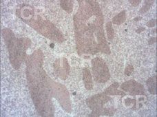 Metallography