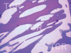 Metallography
