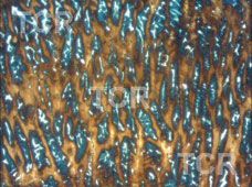 Metallography