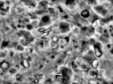Metallography