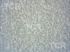 Metallography